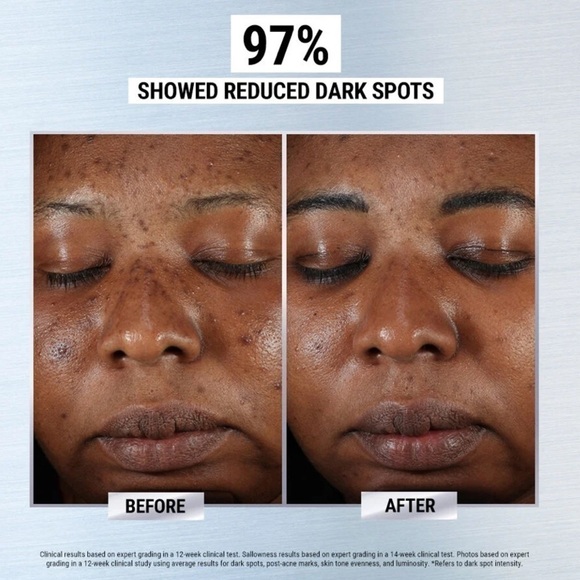 Brand New Kiehl's Clearly Corrective Dark Spot Solution Brightening Face Serum - Picture 14 of 16